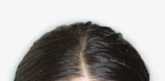 Anti Schuppen Shampoo – Das sollte bei der Anwendung und Auswahl unbedingt beachtet werden!