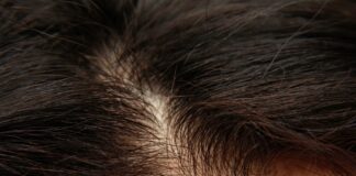 Haarausfall Shampoo – Das sollte bei der Auswahl des Haarausfall Shampoos beachtet werden!