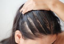 Der richtige Umgang mit Haarausfall und dünner werdendem Haar