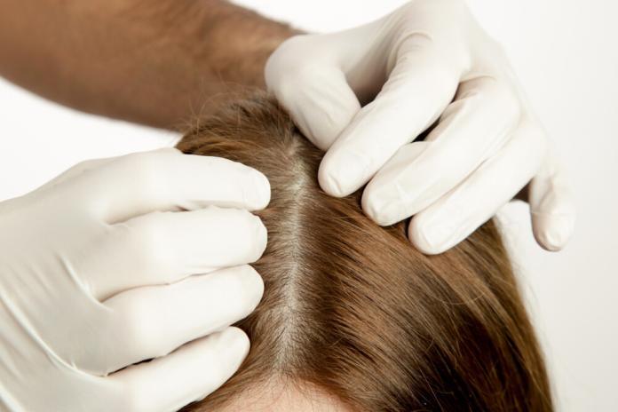 Warum eine professionelle Haaranalyse Ihr Haar transformieren kann